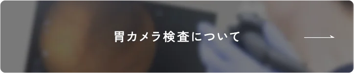 胃カメラ検査について